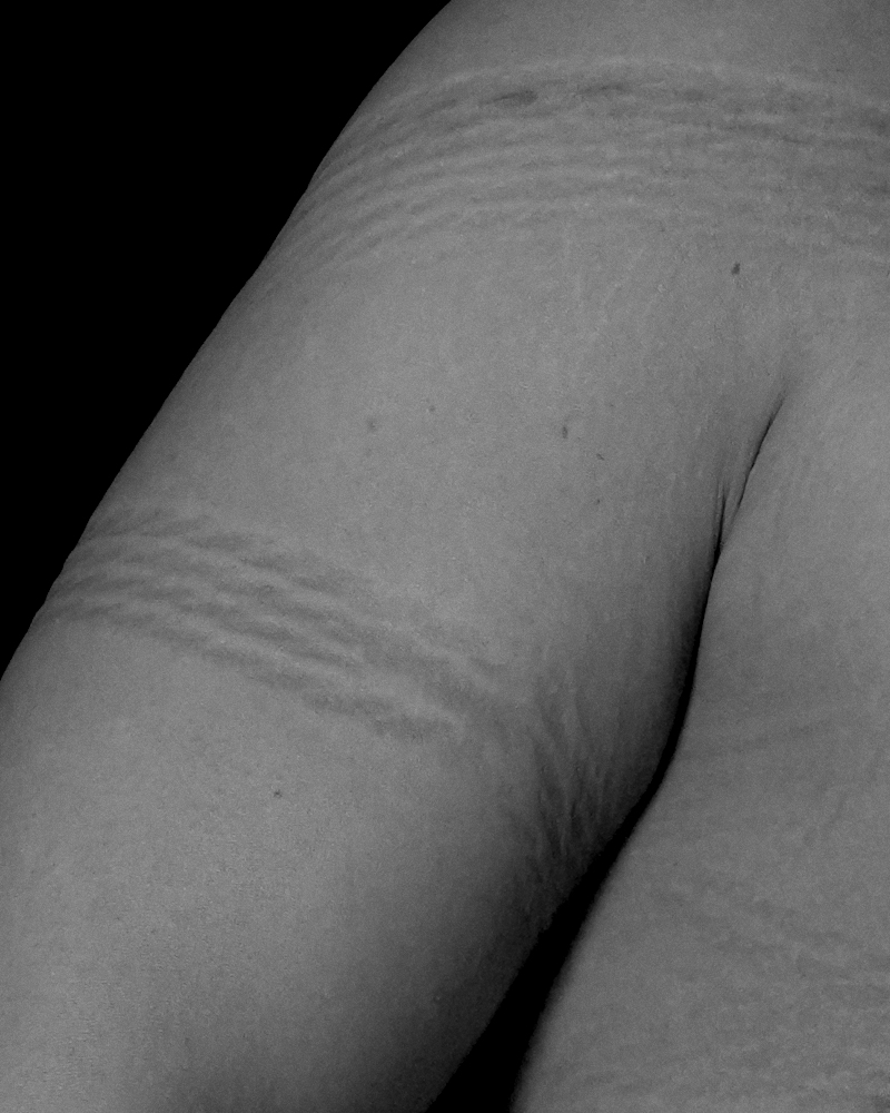 Skin bearing echoes of rope — 縄の記憶を刻む肌